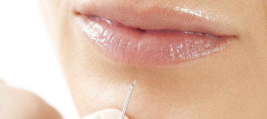 FILLERS